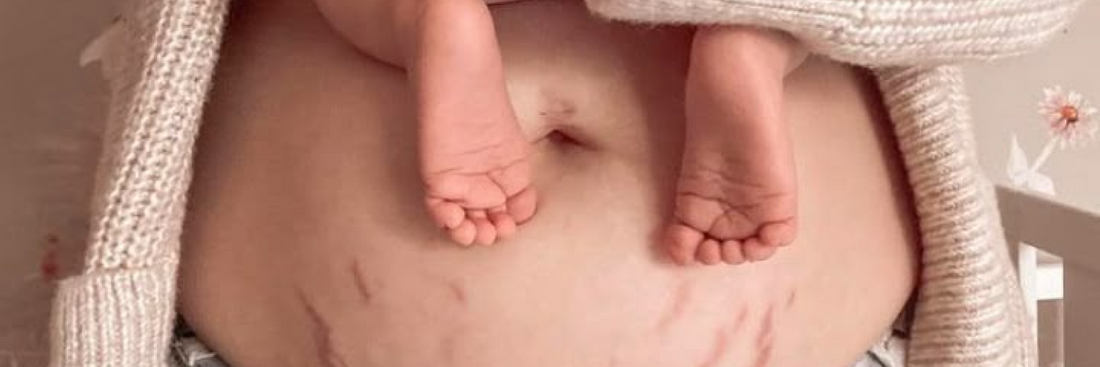 Tu cuerpo en el postparto